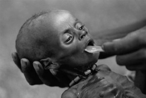 Criança desnutrida e faminta